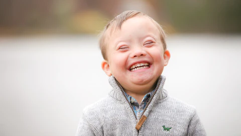 Down_syndrome_480x480
