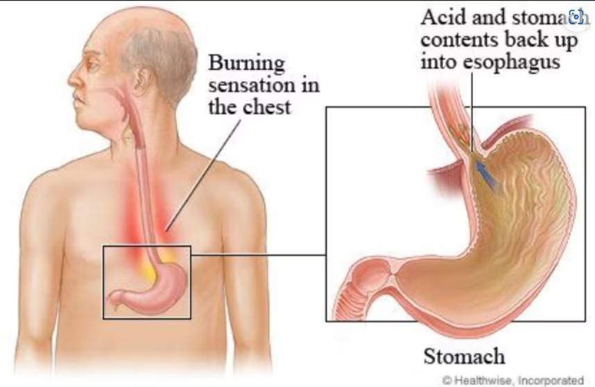 digestive-health